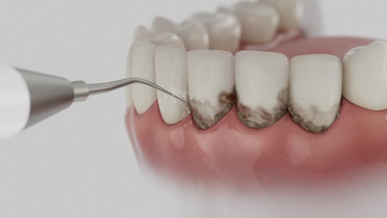 Reliable Emergency Dentist contractor in Carey, OH by Smile Center Dentistry